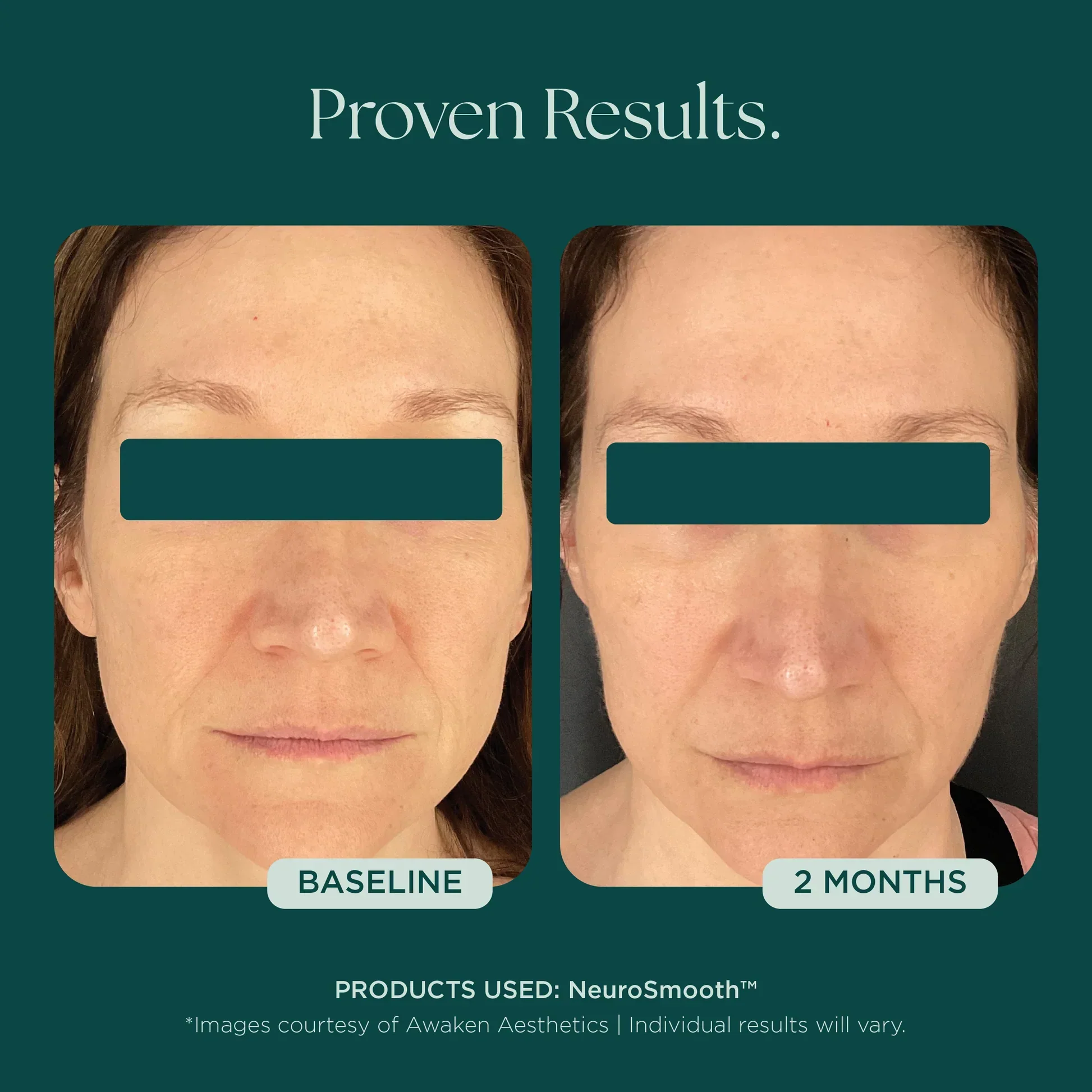 NeuroSmooth® - Image 11