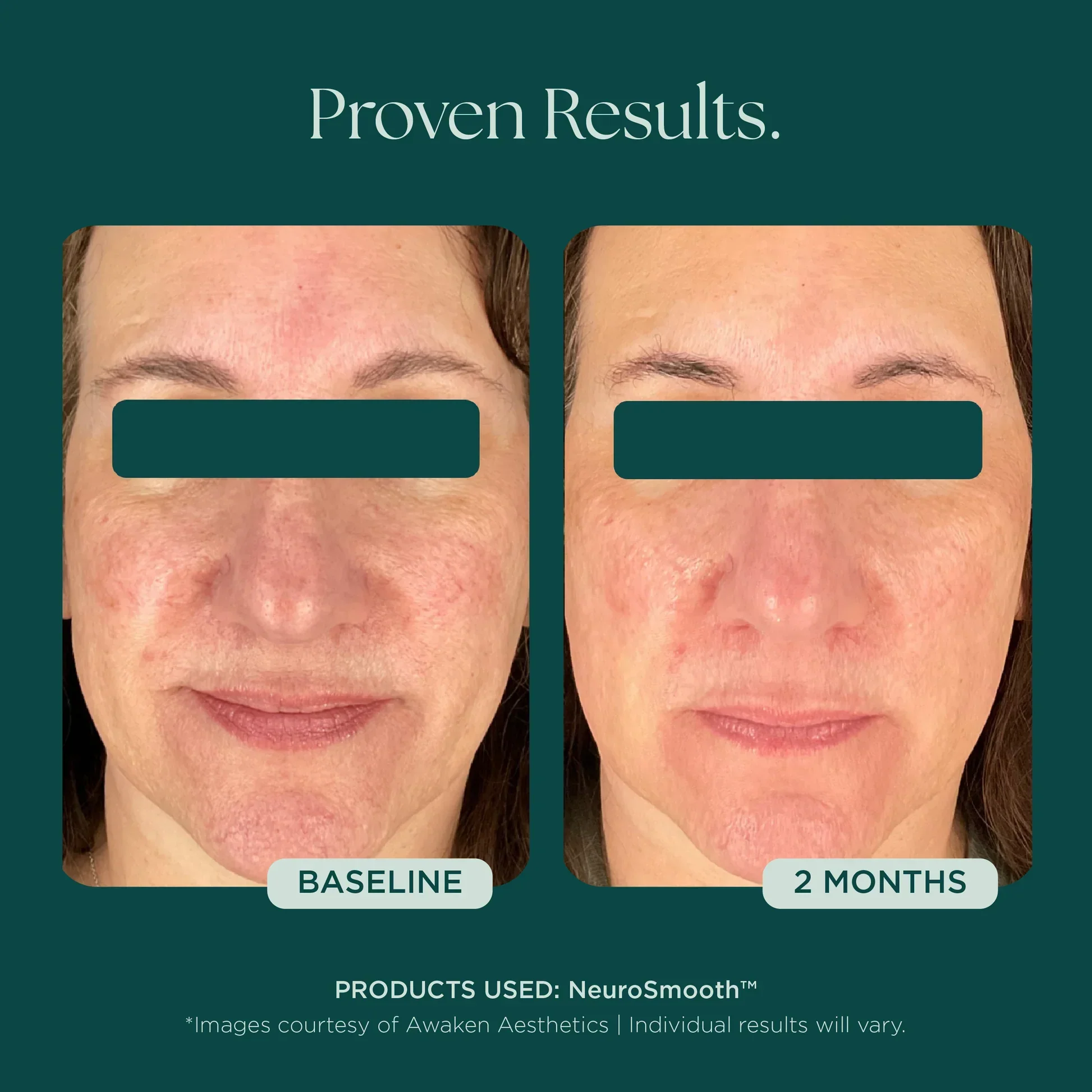 NeuroSmooth® - Image 12