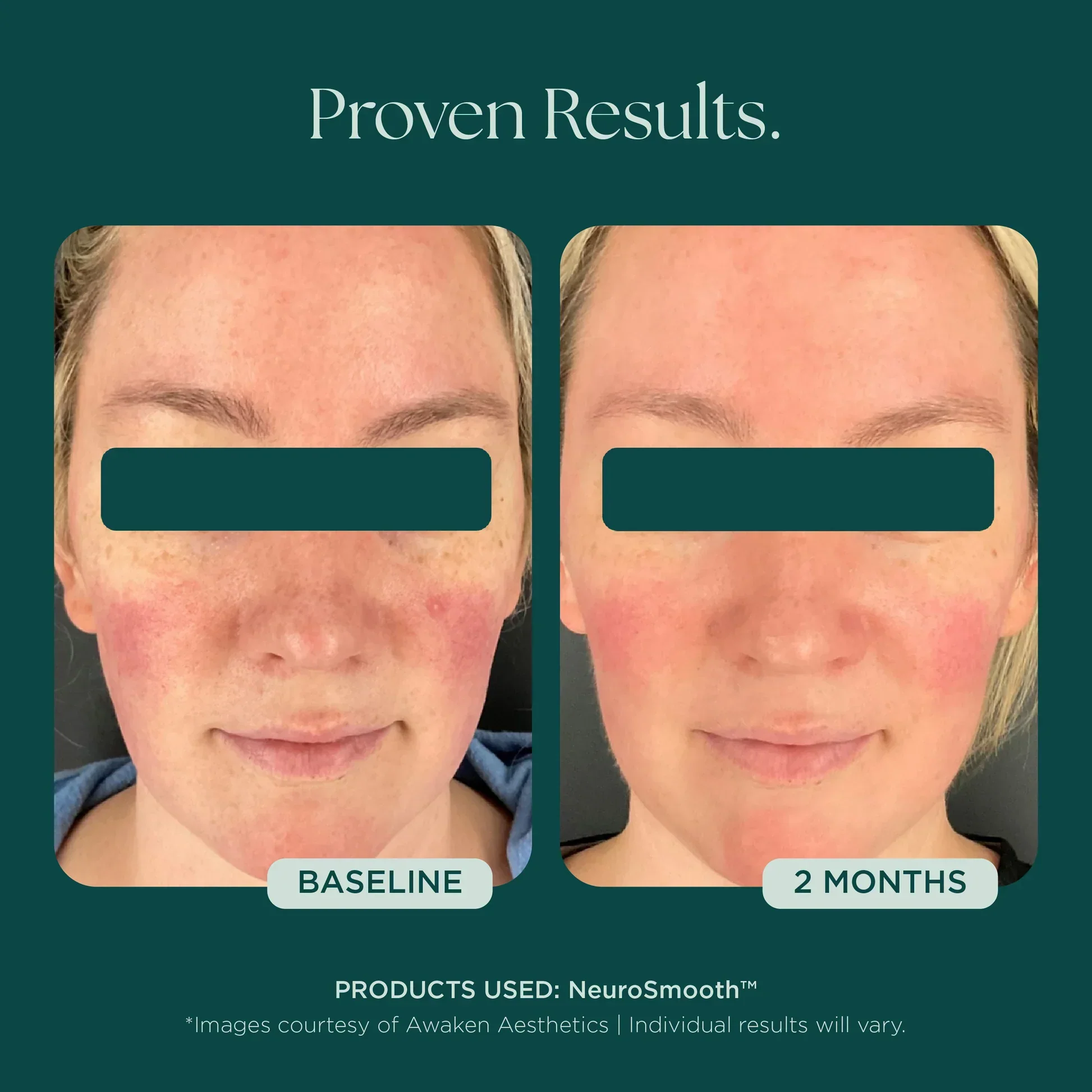 NeuroSmooth® - Image 13