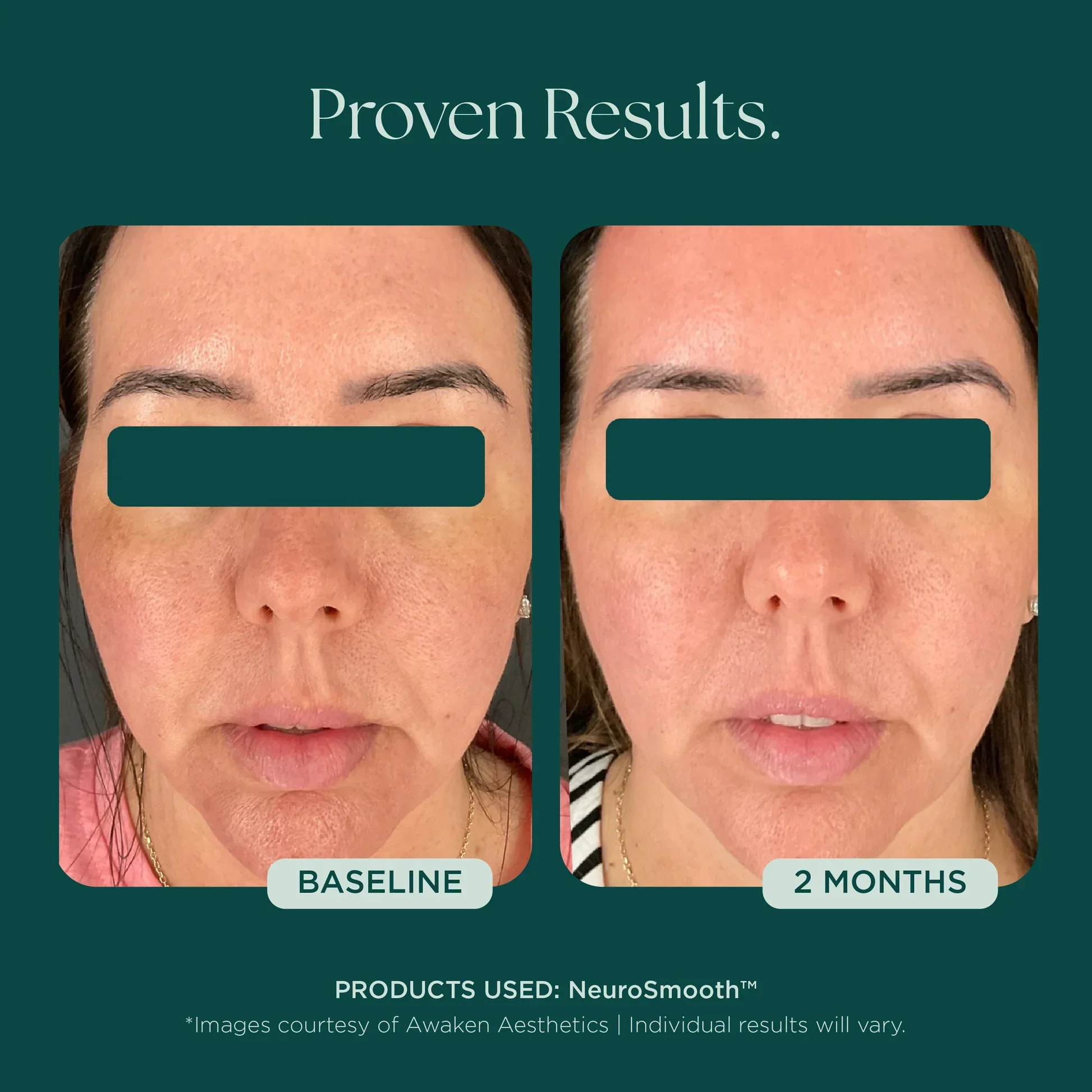 NeuroSmooth® - Image 14