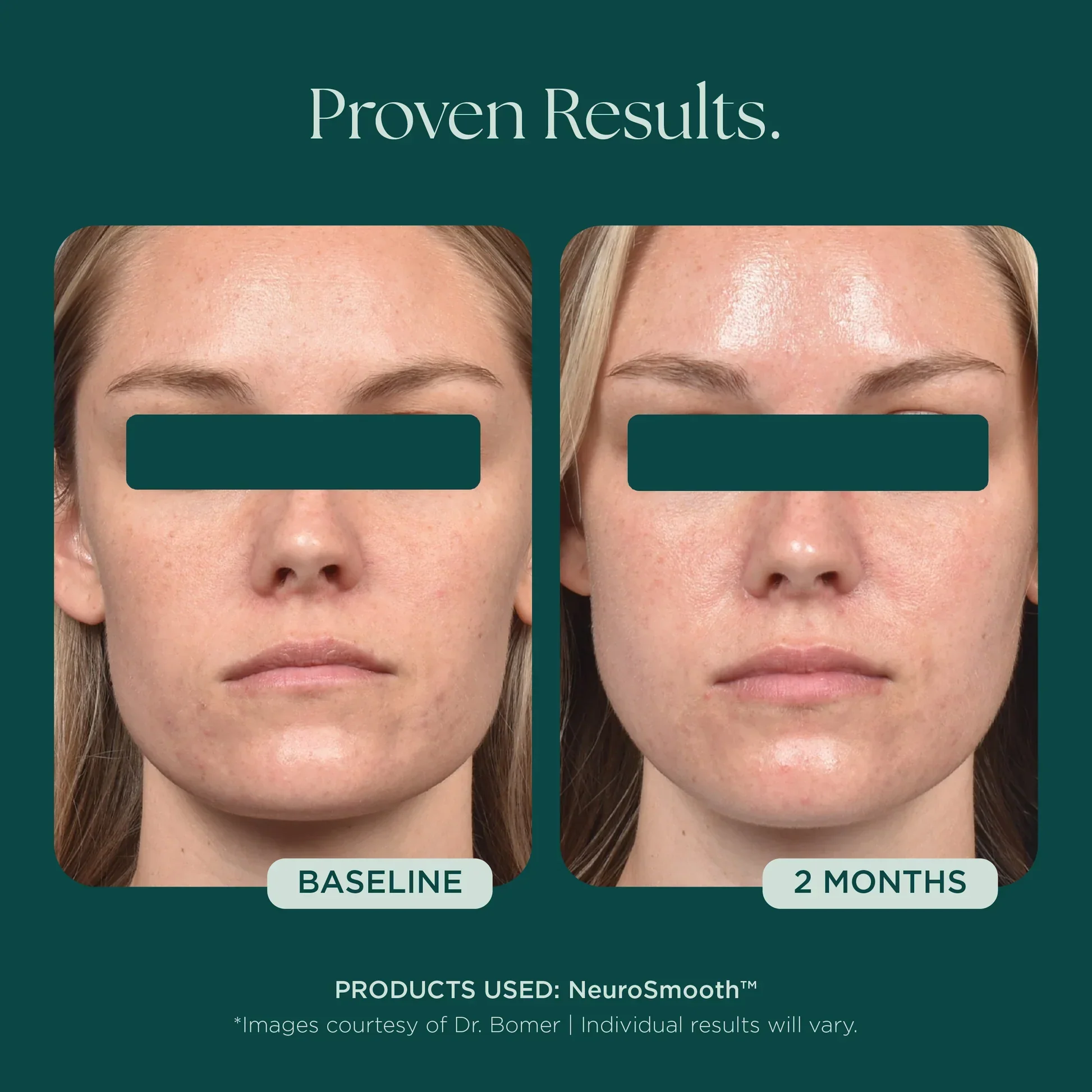 NeuroSmooth® - Image 5