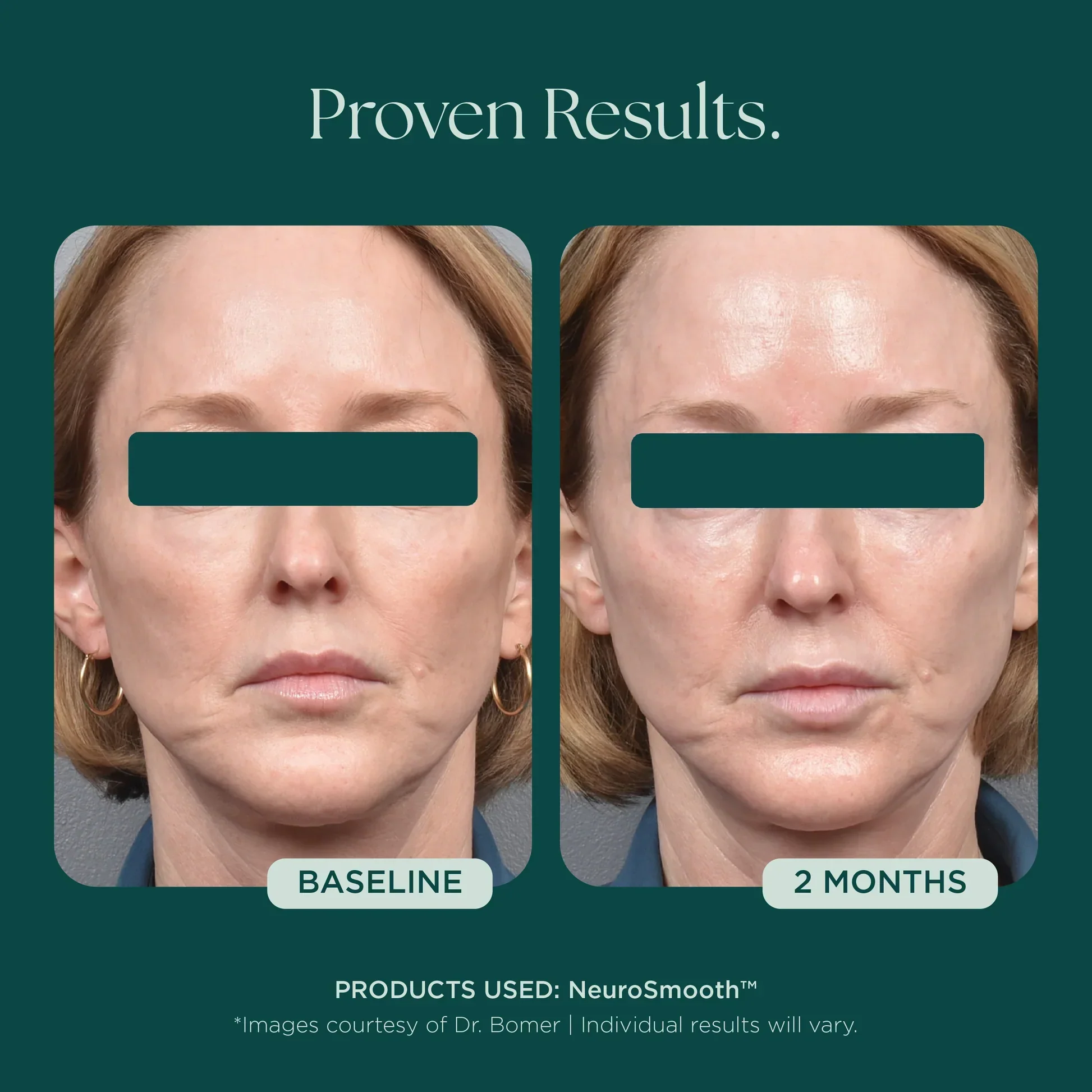 NeuroSmooth® - Image 6