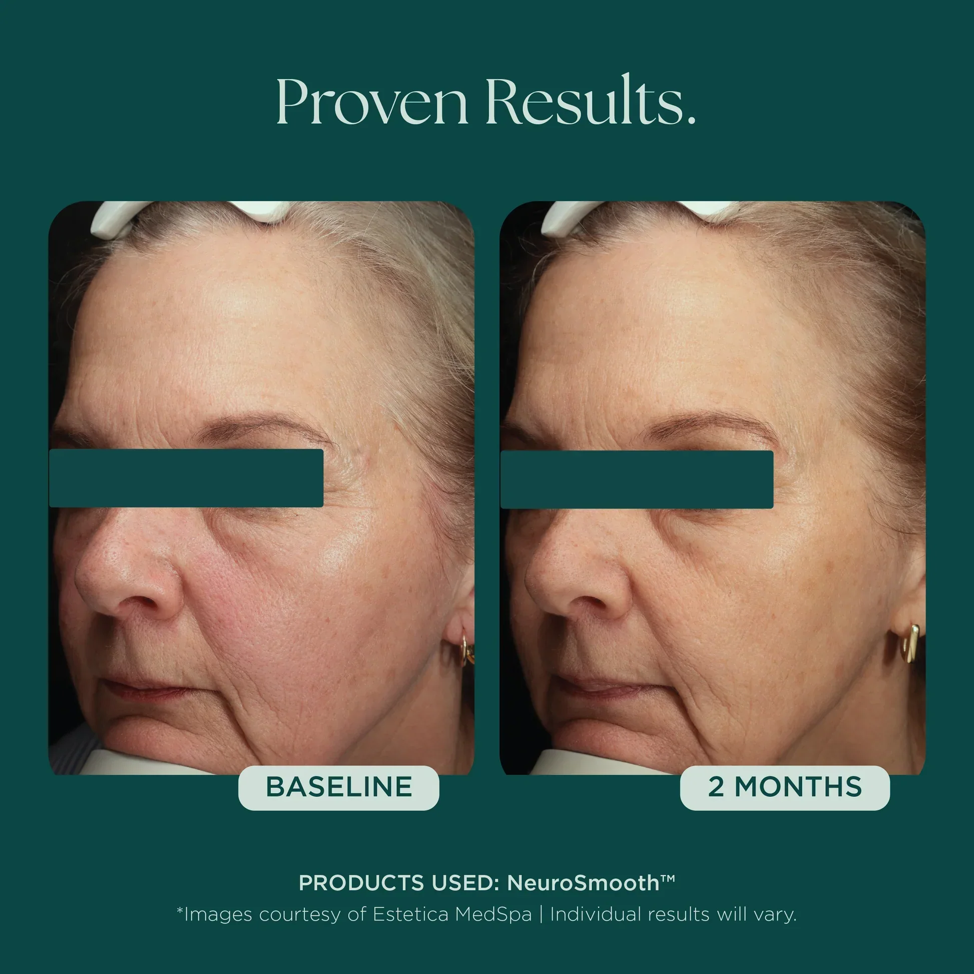 NeuroSmooth® - Image 7