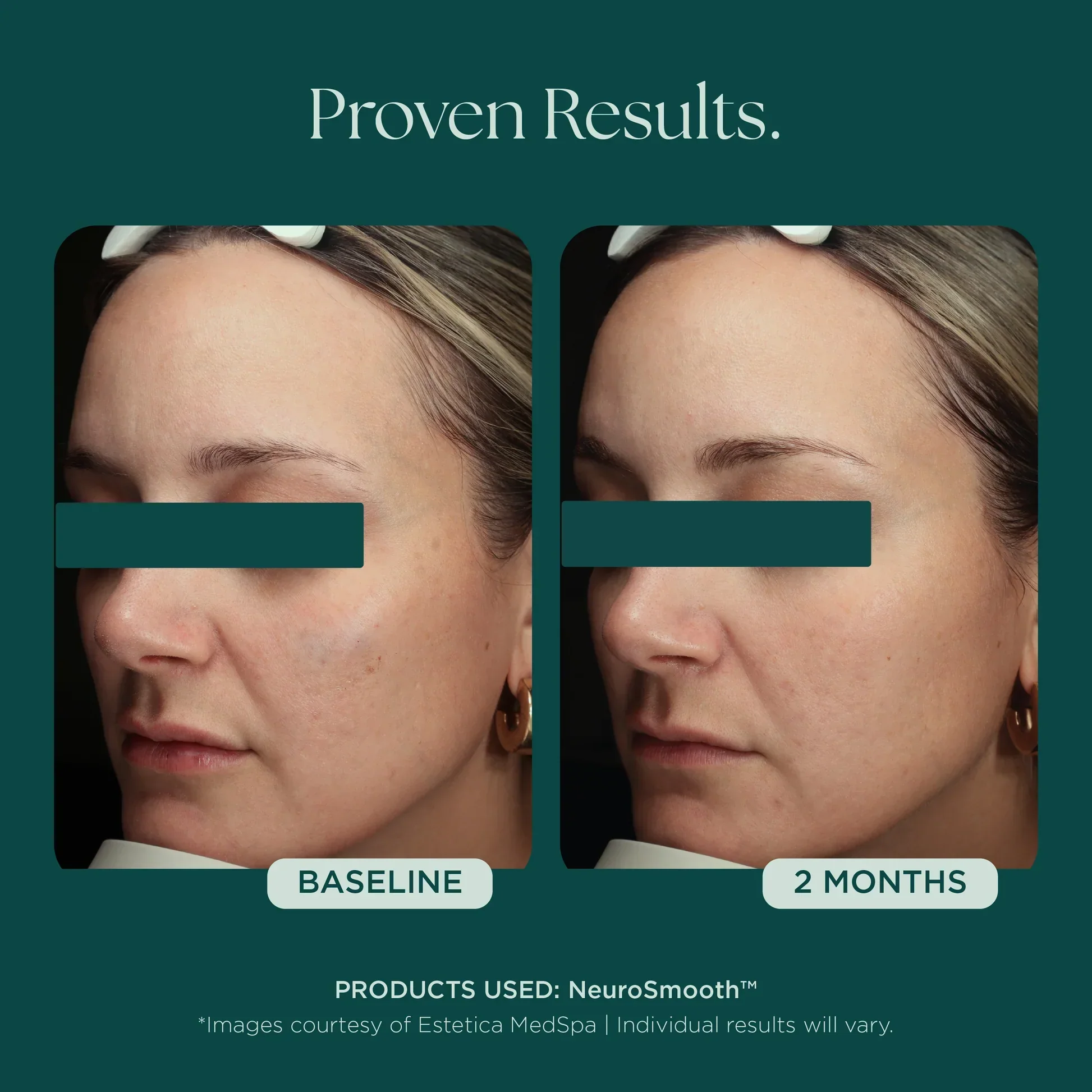 NeuroSmooth® - Image 9