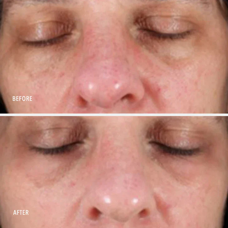 NIMNI DAY CREAM - Patented Collagen Support Complex - Image 3
