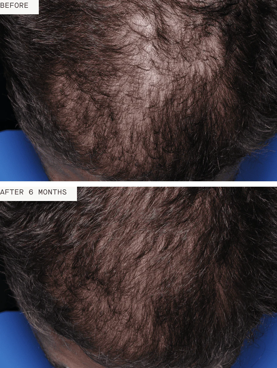 Nutrafol Men - Image 4
