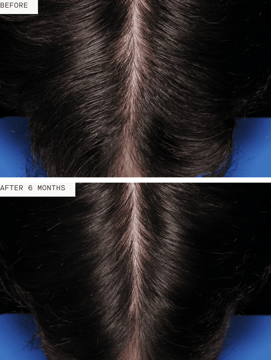 Nutrafol Men - Image 5