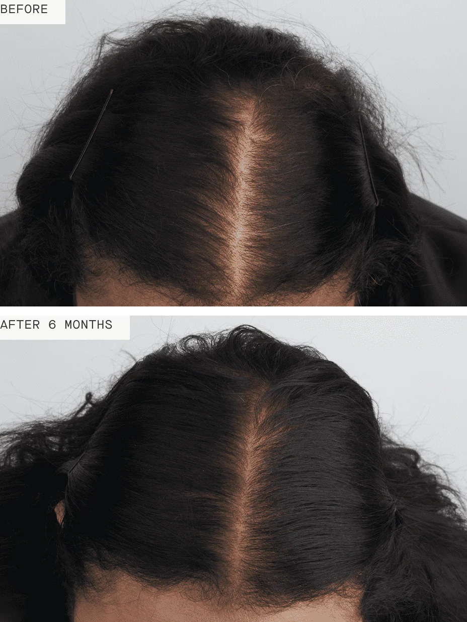 Nutrafol Women's Balance - Image 3