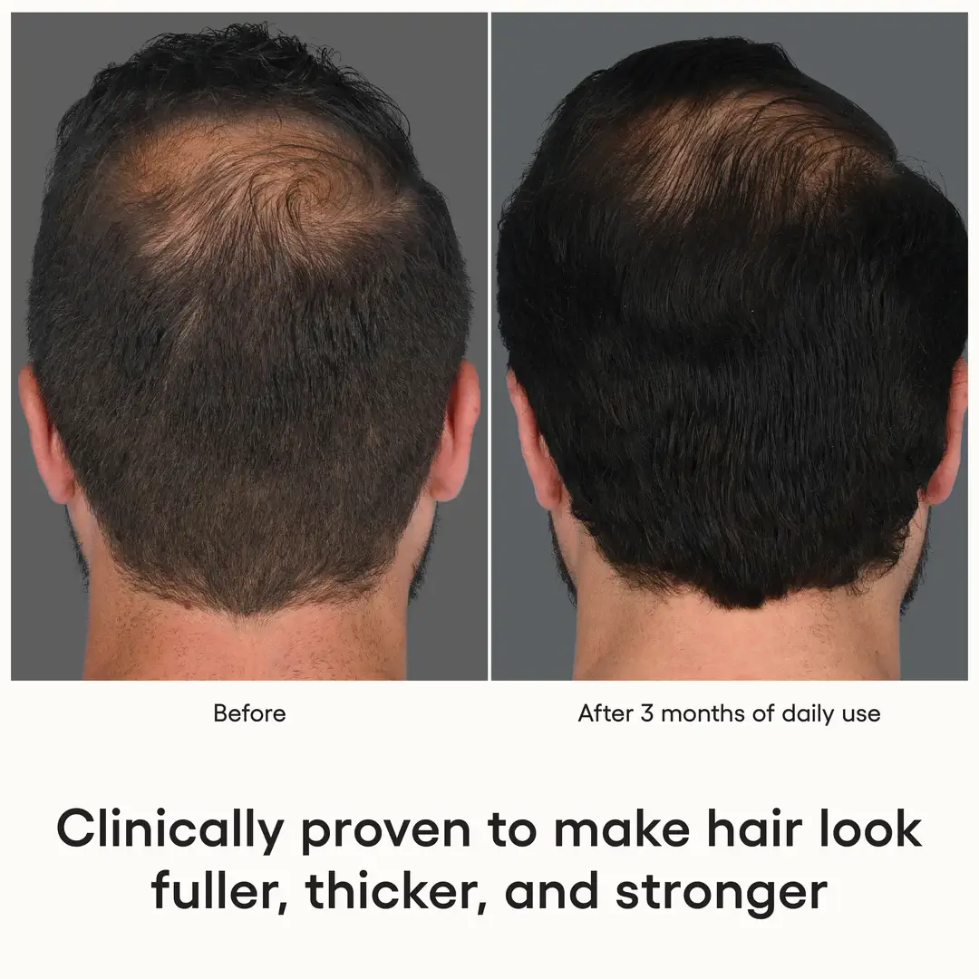 Plated Skin Science HAIR Serum - Image 4