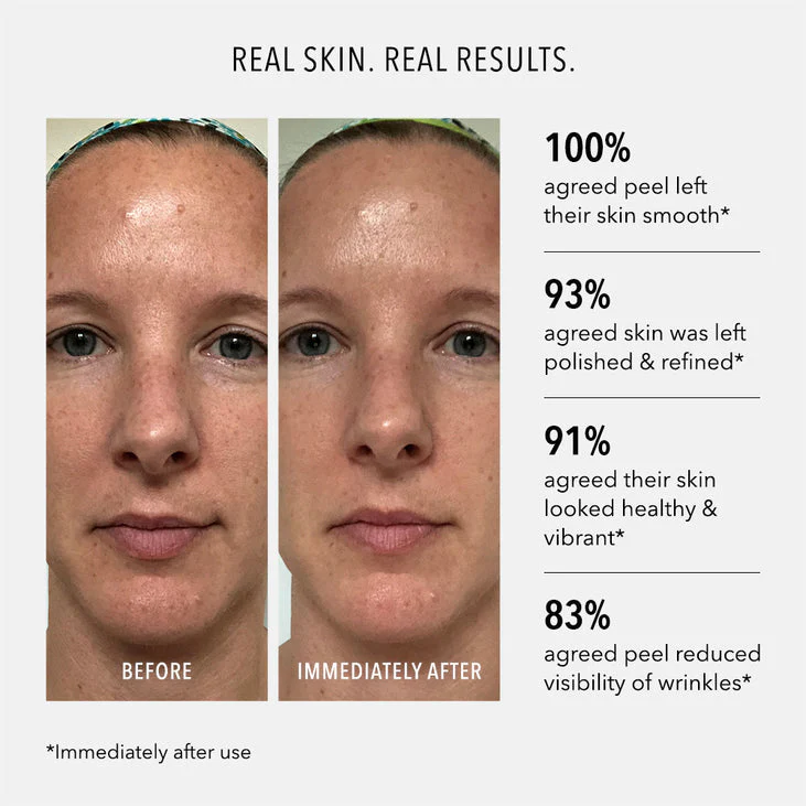 POLISH & PLUMP FACE PEEL - 2 Step System - Image 3
