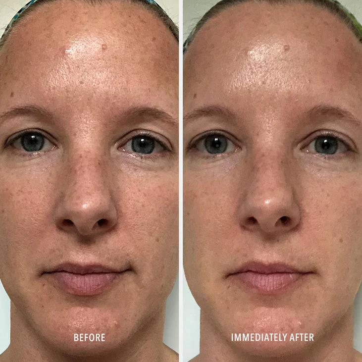 POLISH & PLUMP FACE PEEL - 2 Step System - Image 4