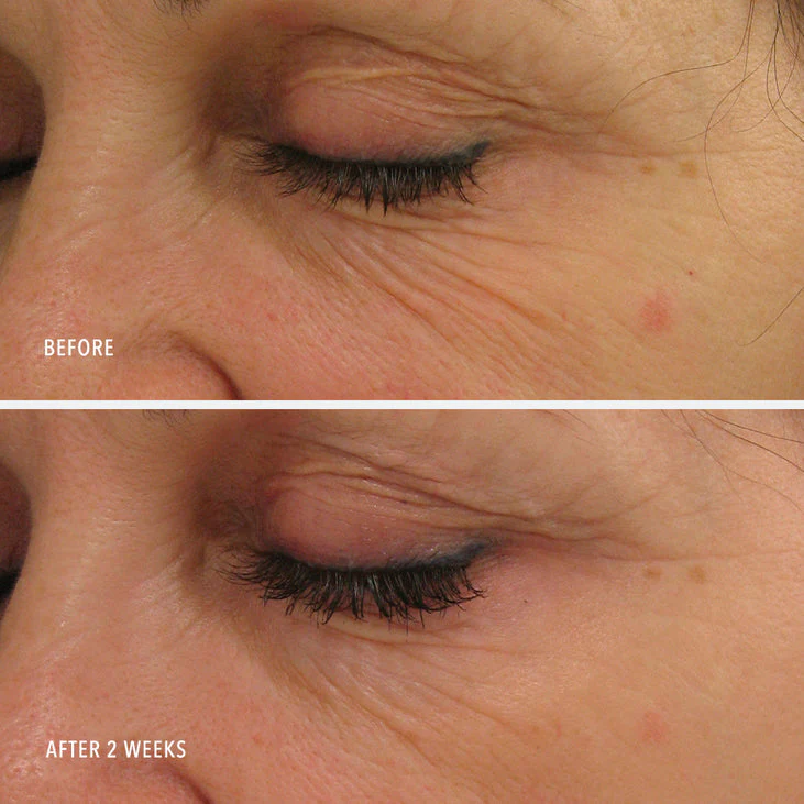 POWER SERUM - Line-Lifting Transformation - Image 4