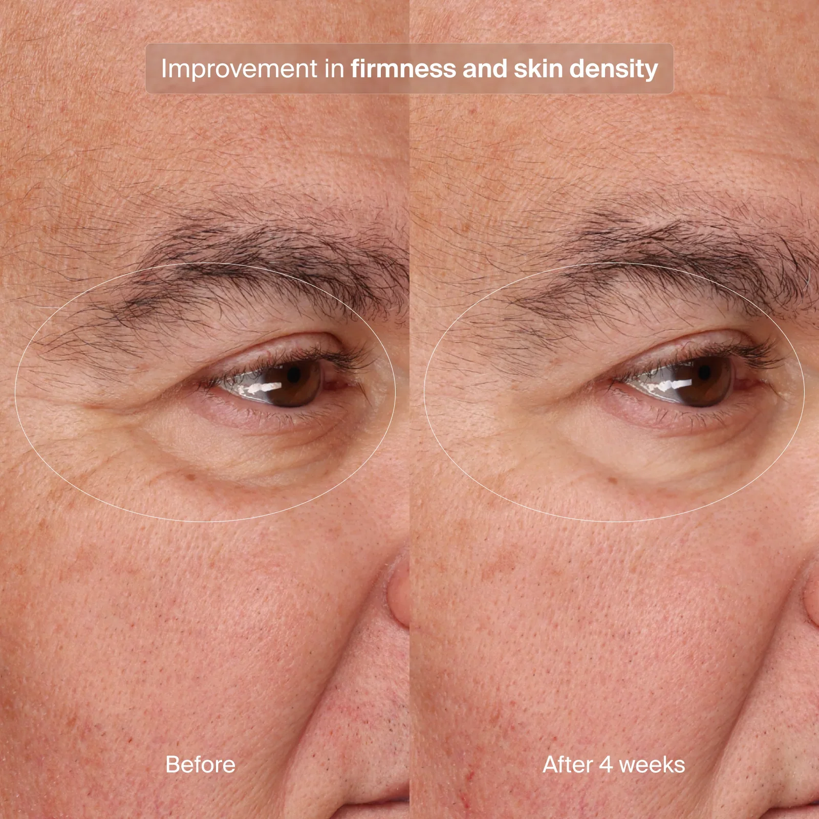 PRECISION EYE LIFT - Image 8