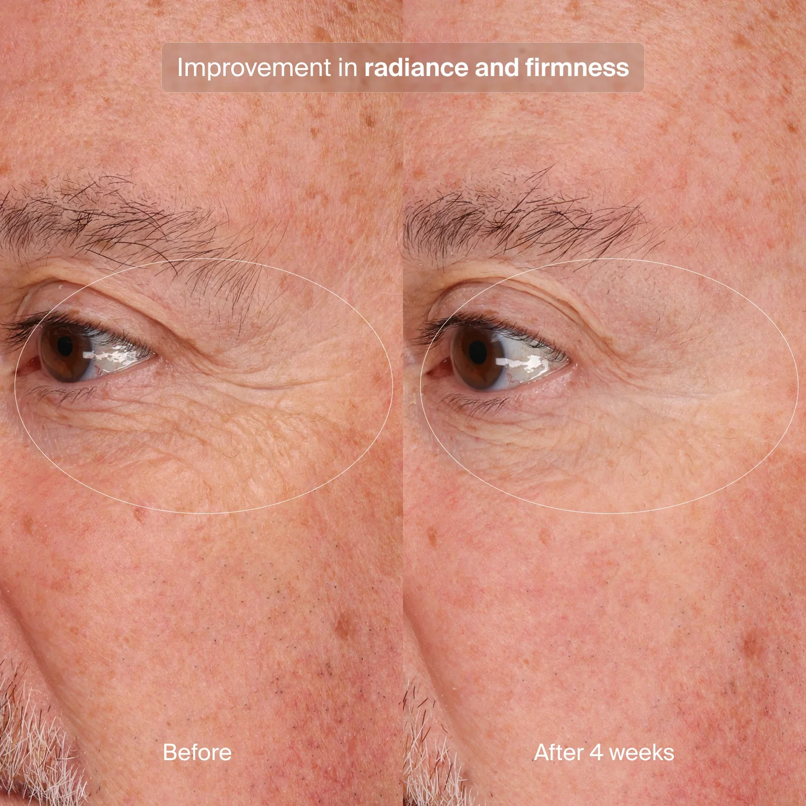 PRECISION EYE LIFT - Image 9