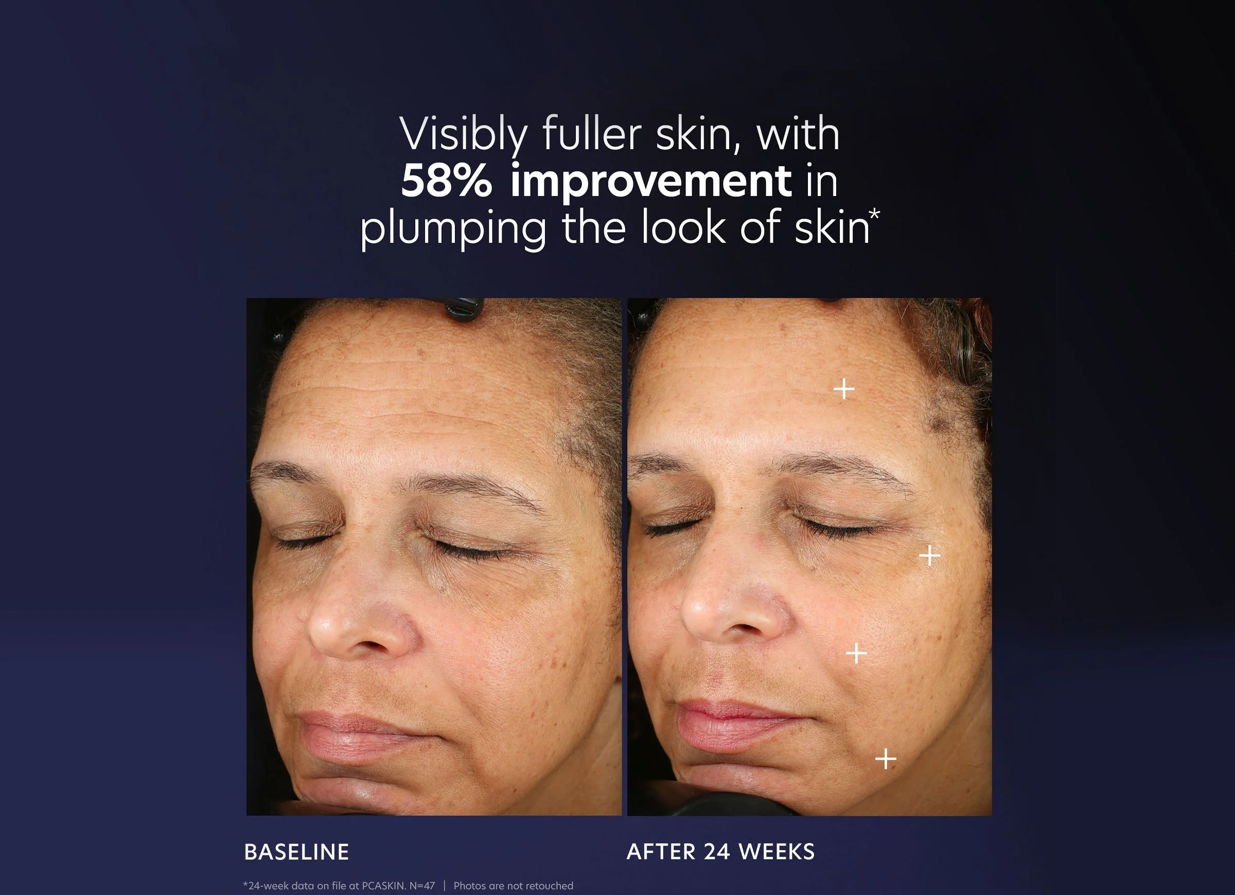 Pro-Max Age Renewal - Image 4