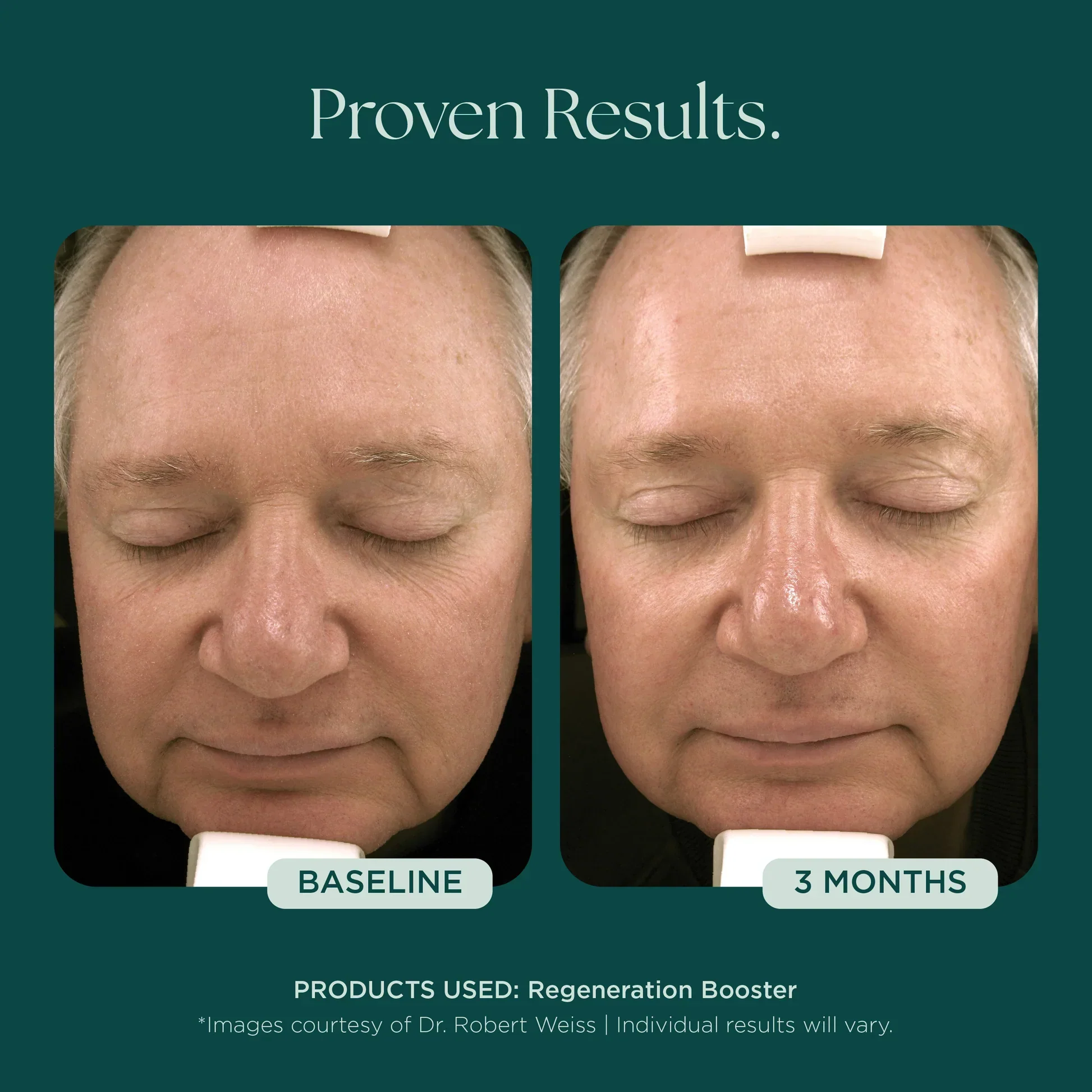 Regeneration Booster - Image 4