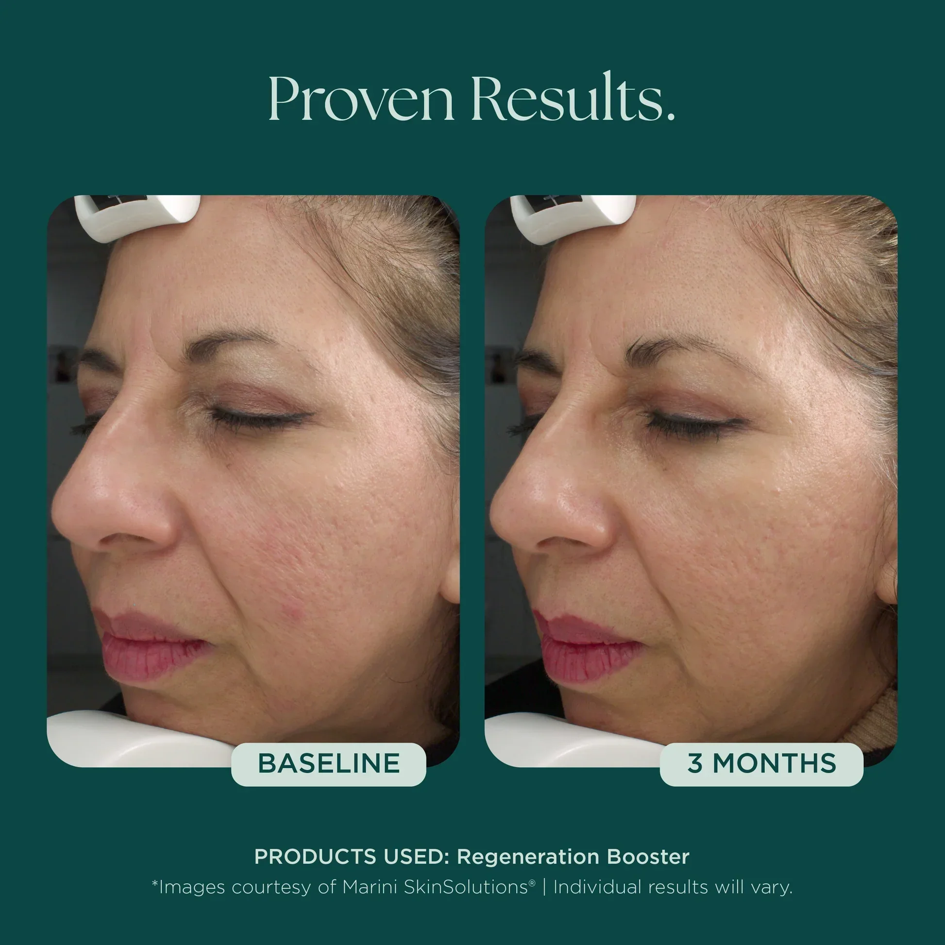 Regeneration Booster - Image 5