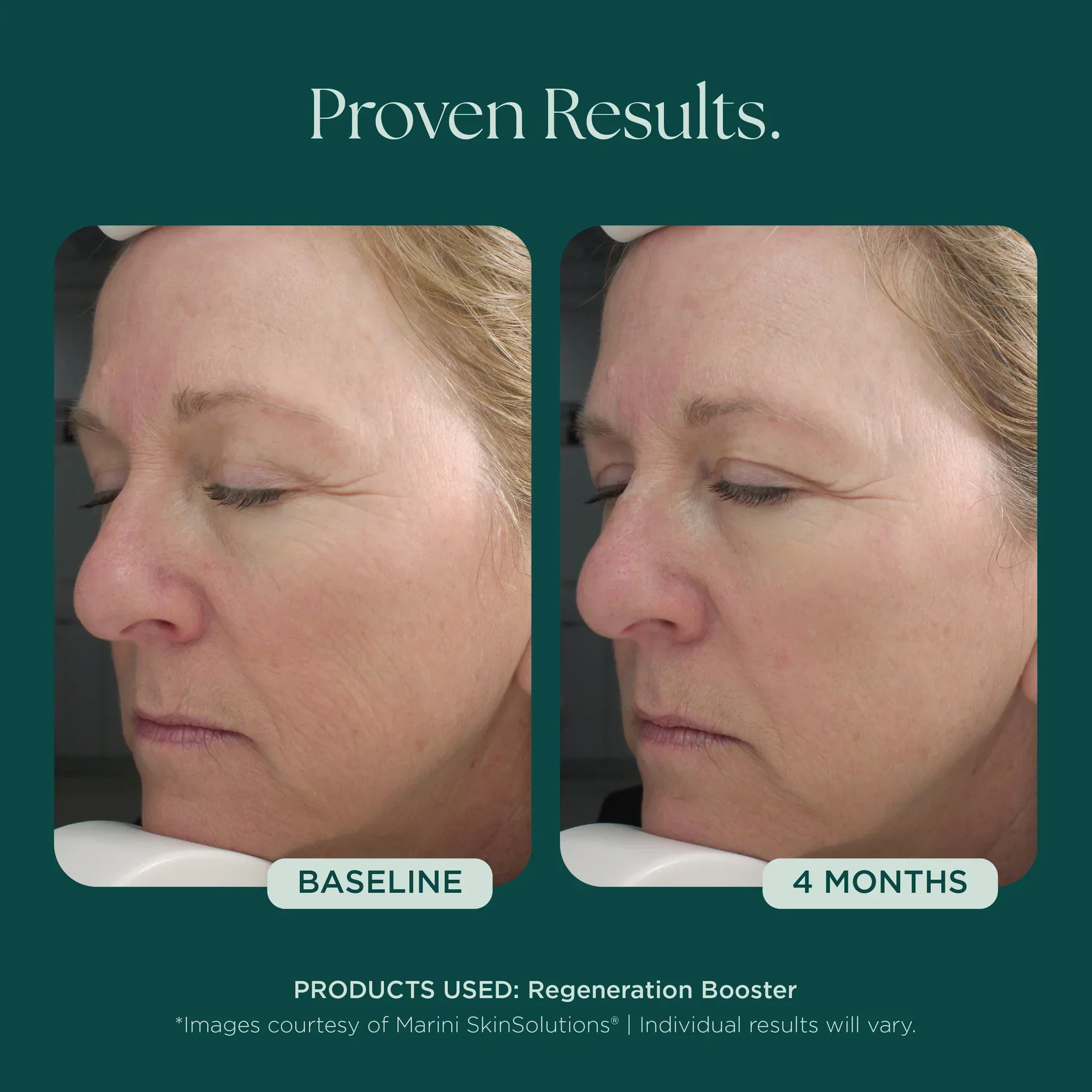 Regeneration Booster - Image 6