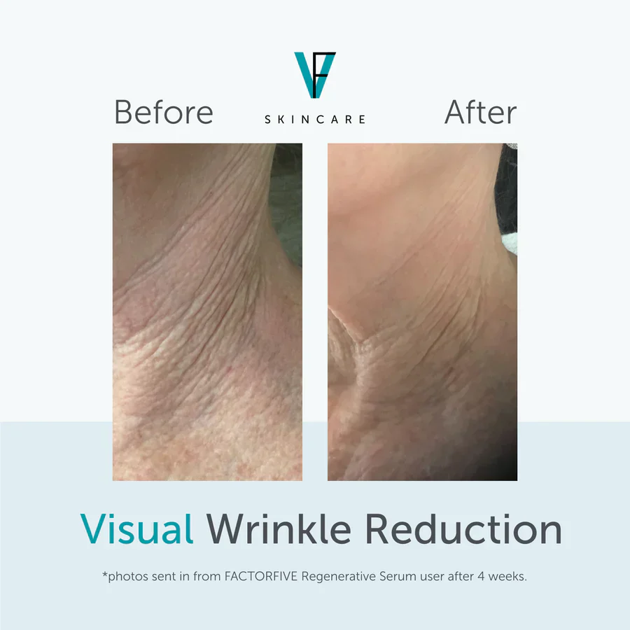 Regenerative Serum - Image 4