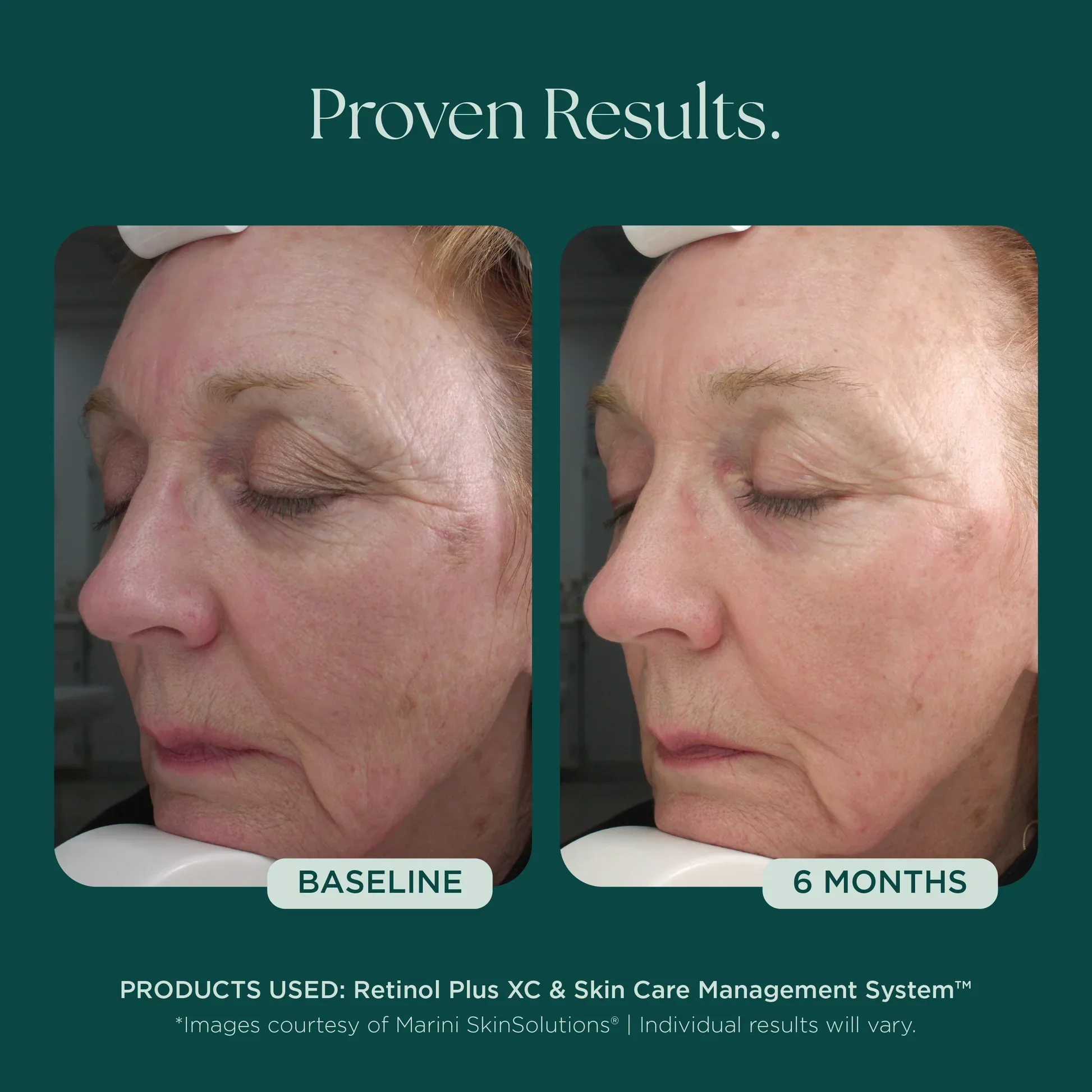 Retinol Plus - Image 3