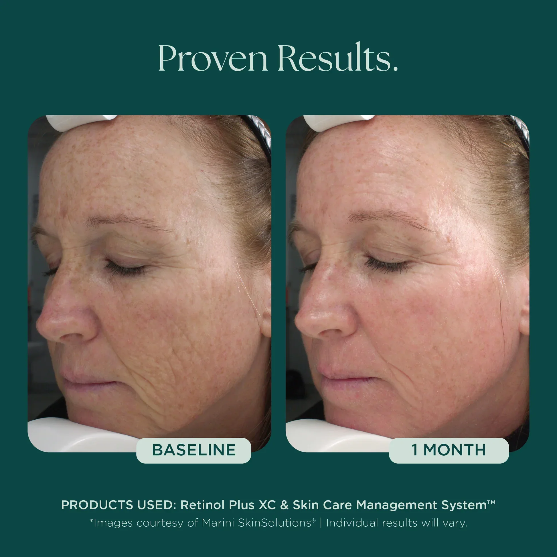 Retinol Plus - Image 4