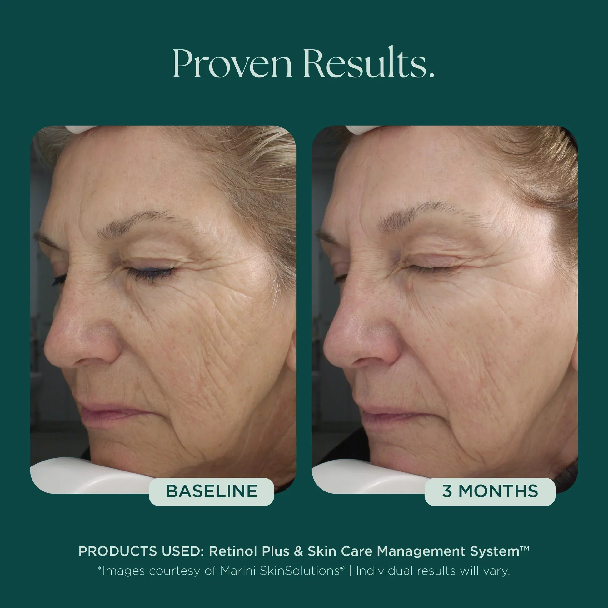 Retinol Plus - Image 6