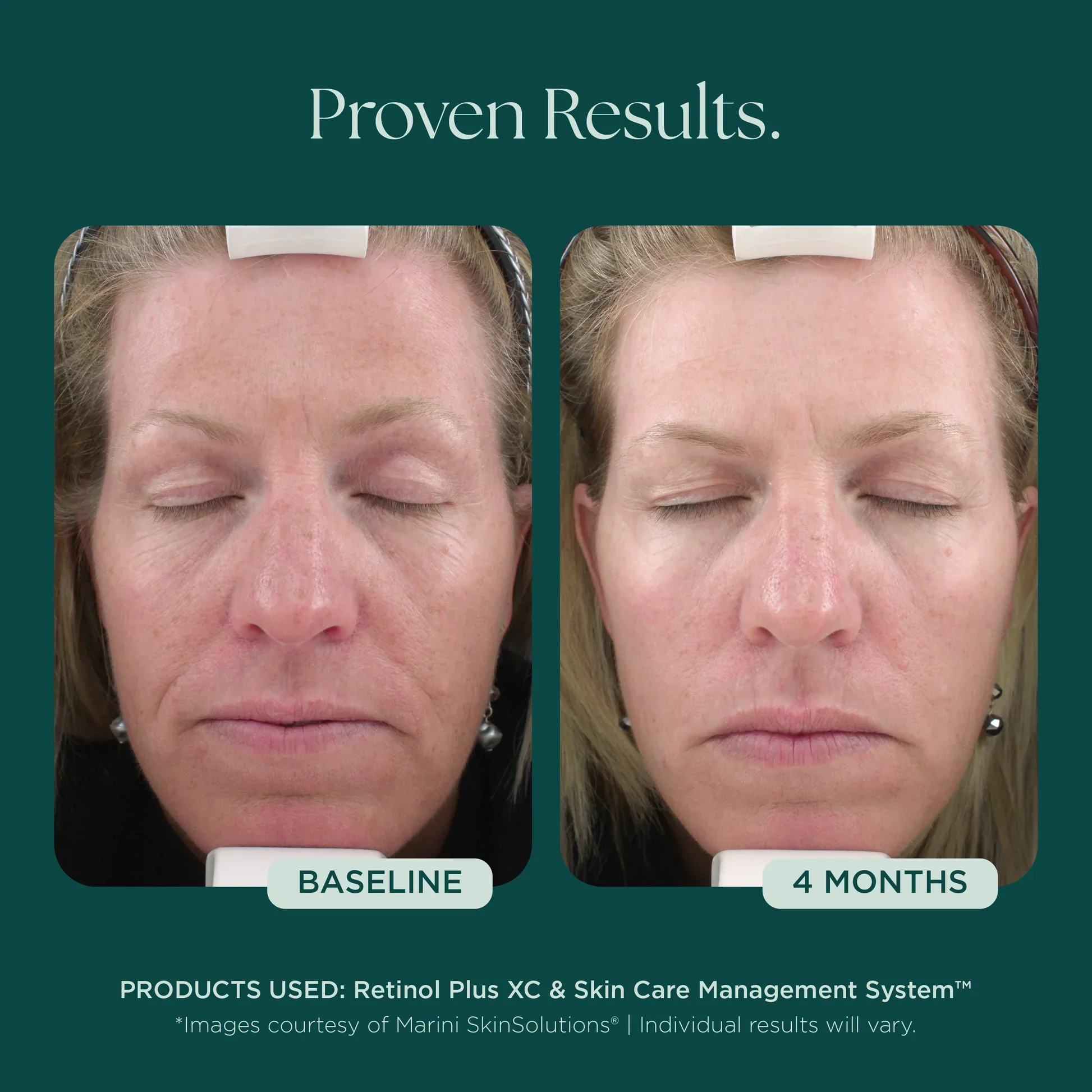 Retinol Plus XC - Image 5