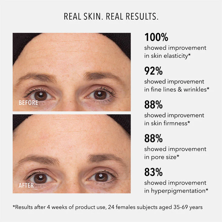 RETINOL ROUTINE BOOSTER - 1% Retinol Solution - Image 3