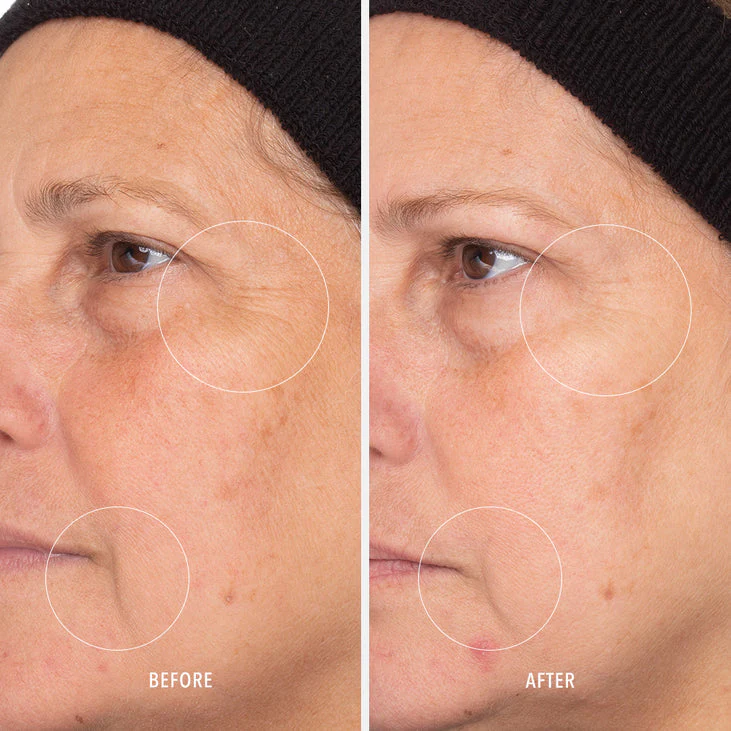 RETINOL ROUTINE BOOSTER - 1% Retinol Solution - Image 4