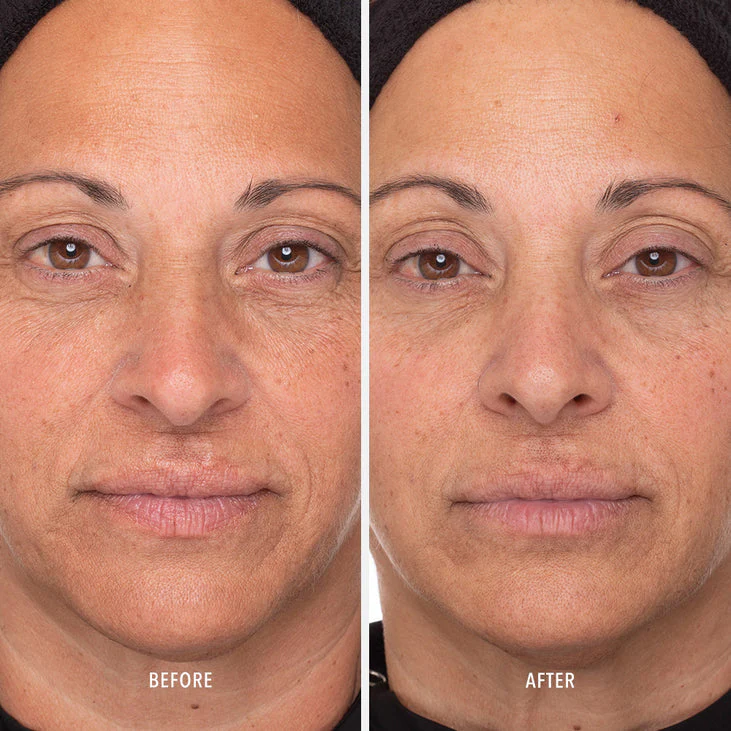 RETINOL ROUTINE BOOSTER - 1% Retinol Solution - Image 5