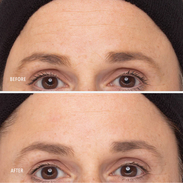 RETINOL ROUTINE BOOSTER - 1% Retinol Solution - Image 6