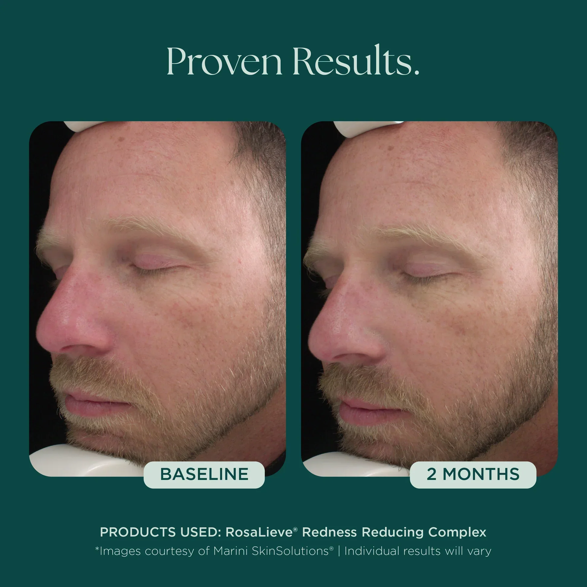 RosaLieve® Redness Reducing Complex - Image 6