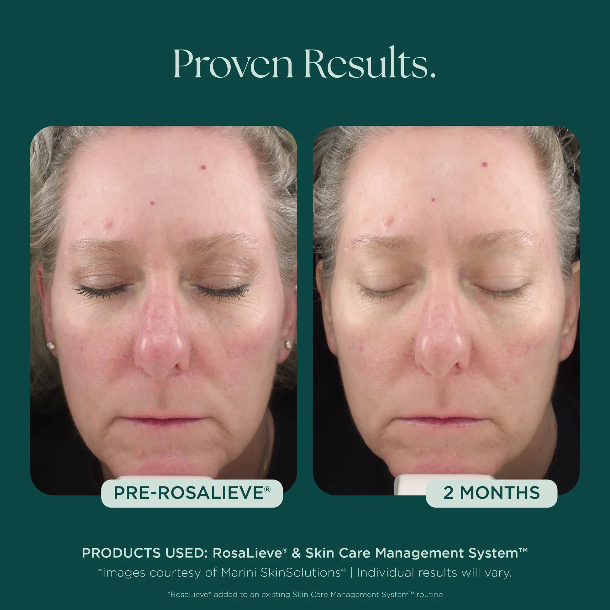 RosaLieve® Redness Reducing Complex - Image 7