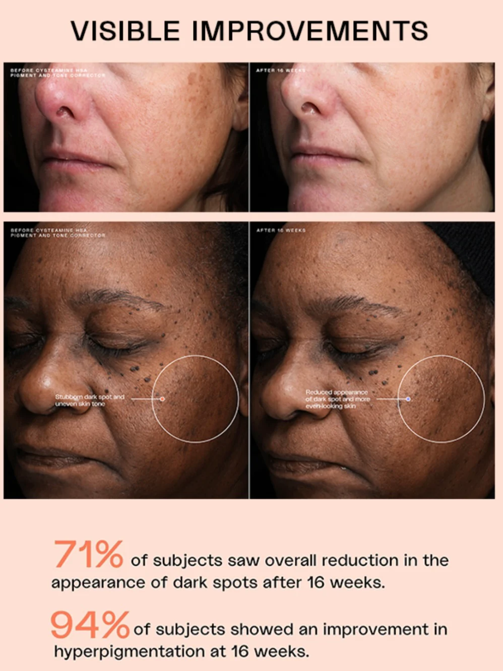 Sente HSA Pigment & Tone Corrector - Image 3