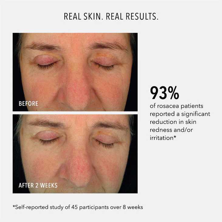 SOOTHING SERUM - Redness Repair & Relief - Image 3