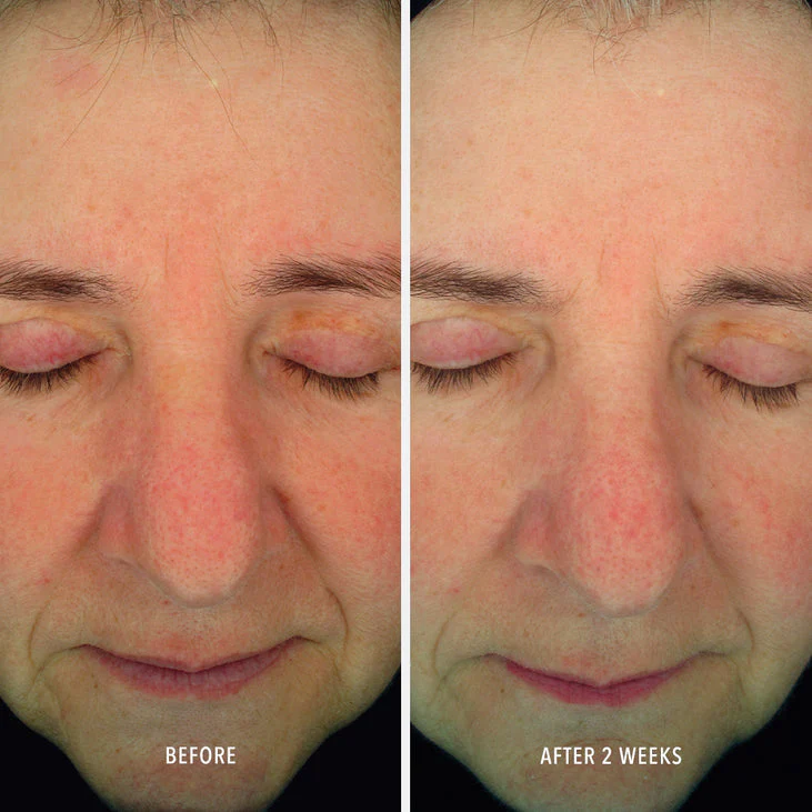 SOOTHING SERUM - Redness Repair & Relief - Image 4