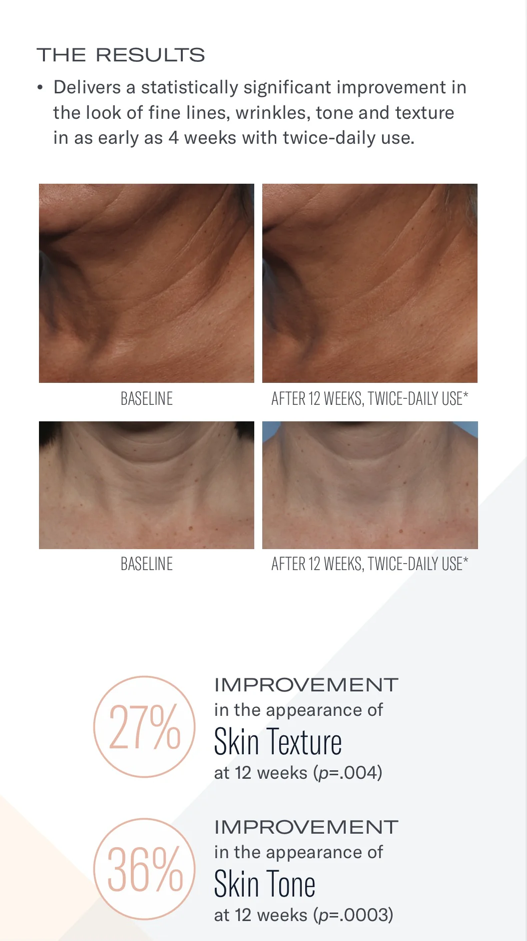 Techno Neck Perfecting Cream - Image 4