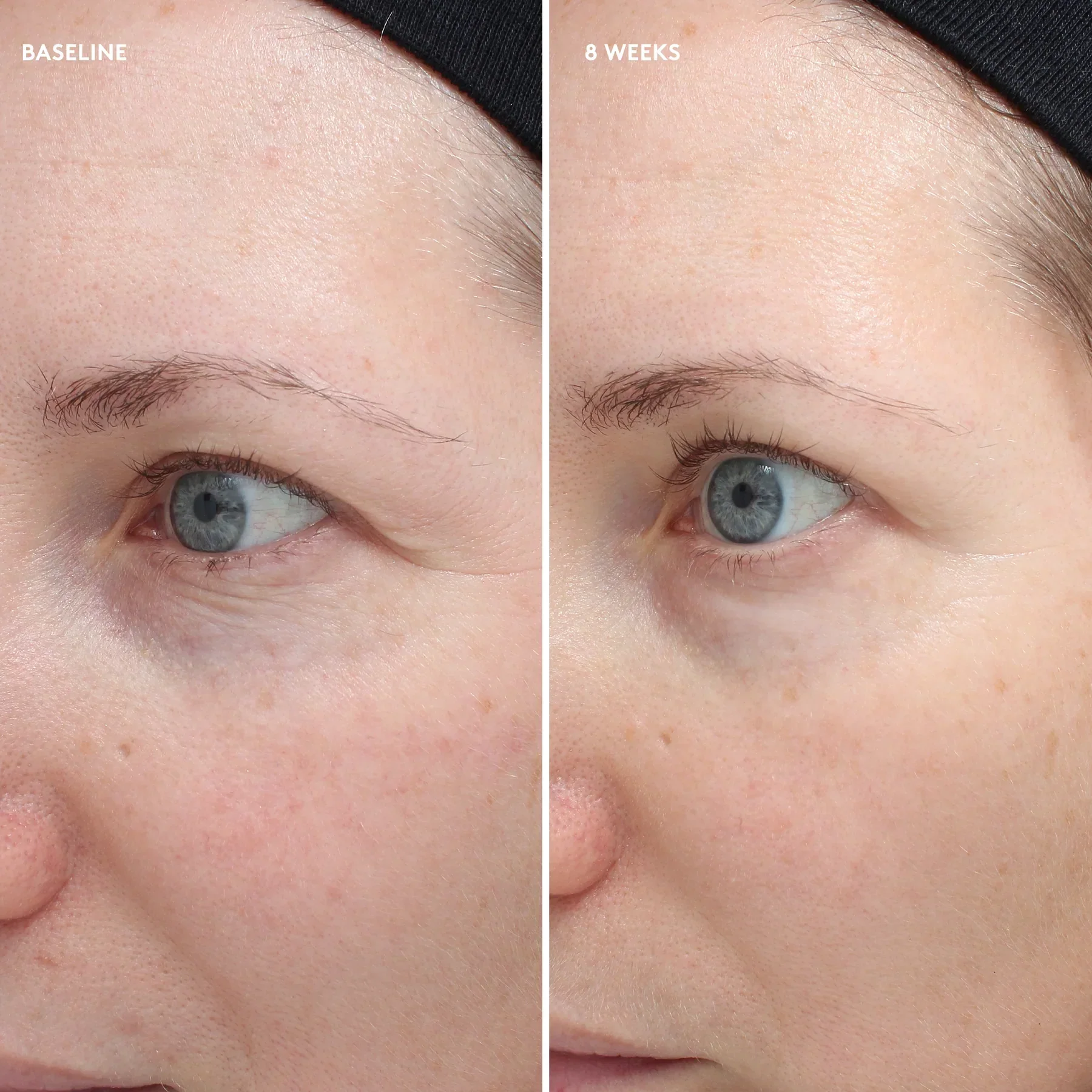Total Eye® Firm & Repair Cream - Image 6