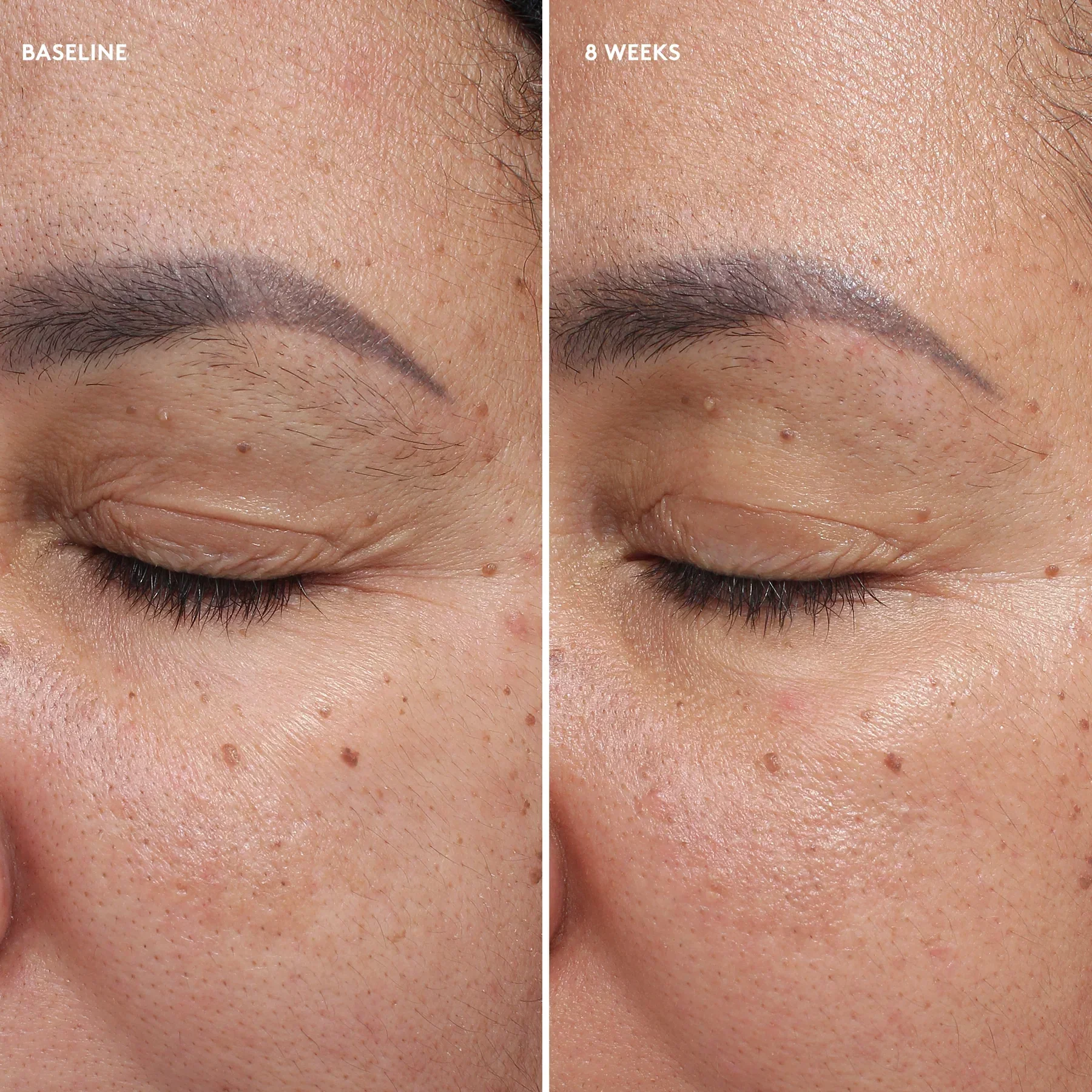 Total Eye® Firm & Repair Cream - Image 7