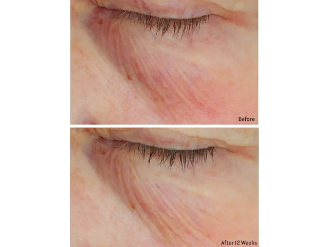 C+ Brightening Eye Complex - Image 5